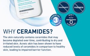 cerave acne control cleanser